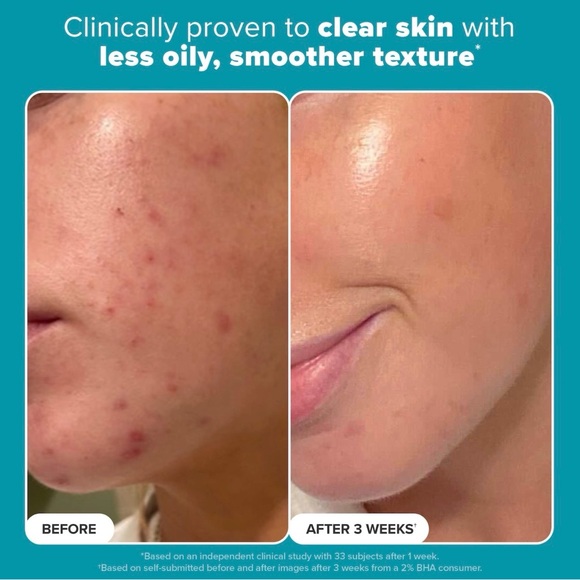 Paula's Choice - Exfoliate 2% BHA - Picture 3 of 5